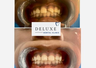Deluxe Dental