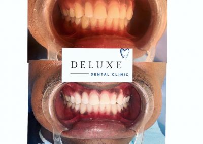 Deluxe Dental